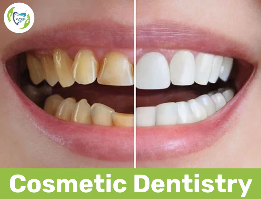 Cosmetic Dentistry in Kaithal