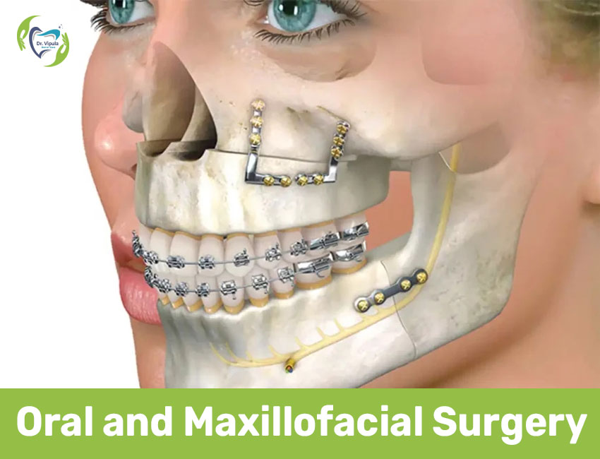 Oral and Maxillofacial Surgery