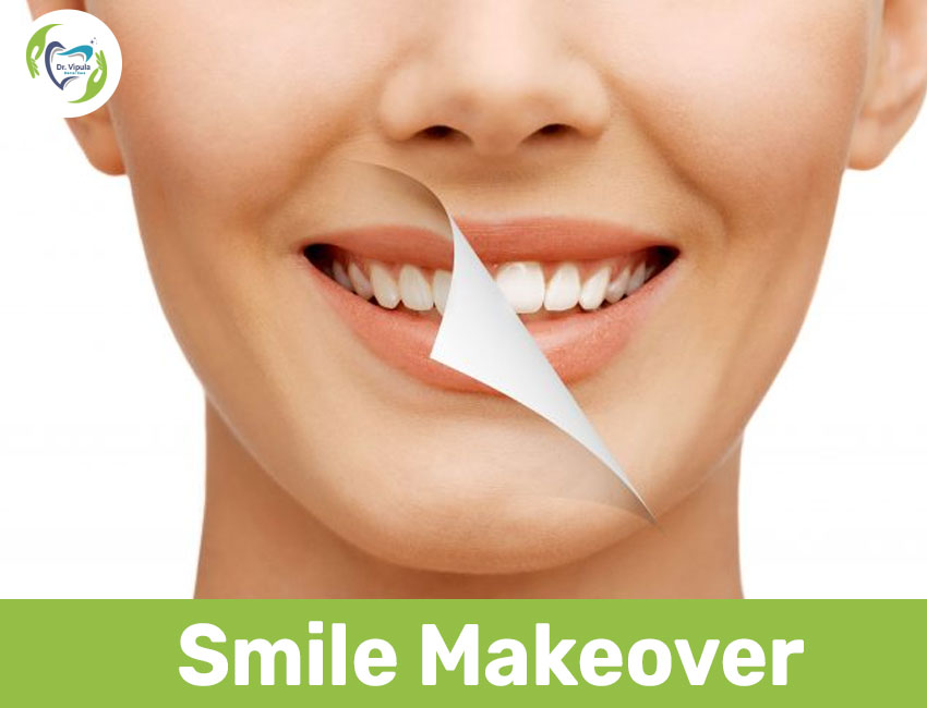 Smile makeover in kaithal